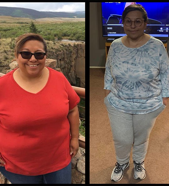 Annette's weight loss transformation