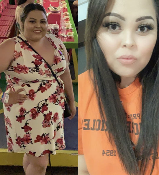 Paloma's weight loss transformation