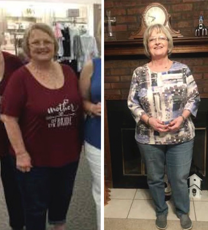 Brenda's weight loss transformation