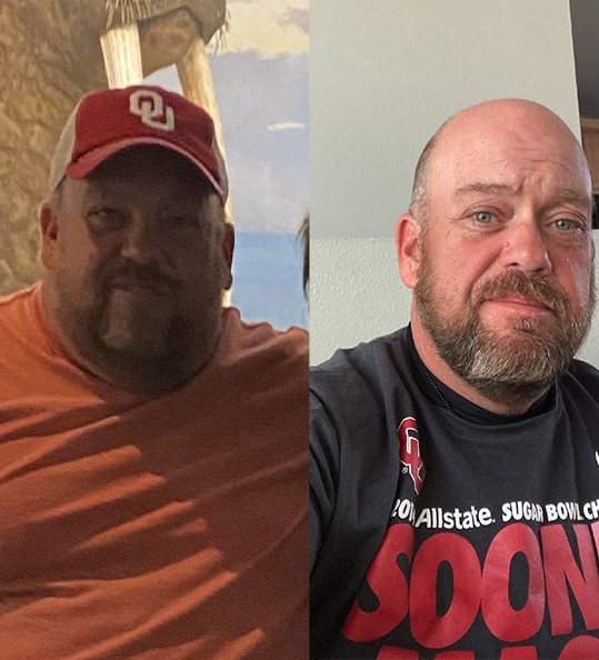 Allen's weight loss transformation