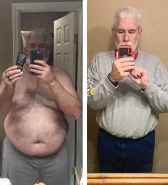 Daniel's weight loss transformation