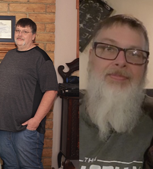 Daniel's weight loss transformation