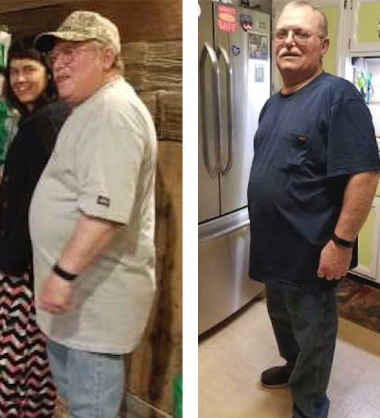 Ernest's weight loss transformation