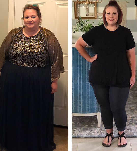 Grace's weight loss transformation