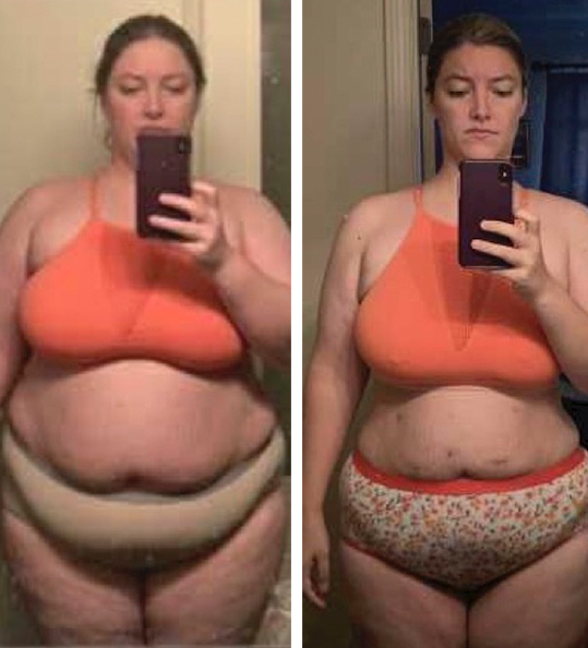 Jessica's weight loss transformation