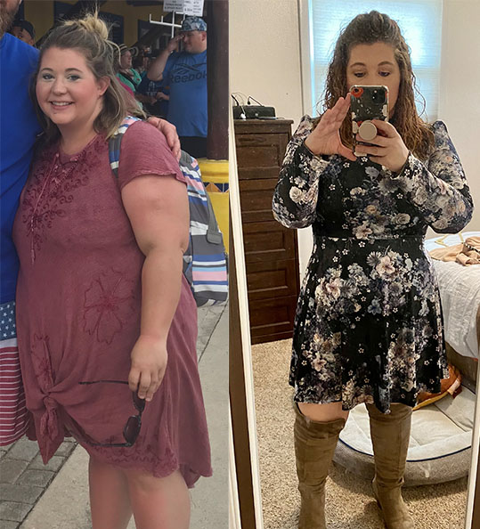 Kelly's weight loss transformation