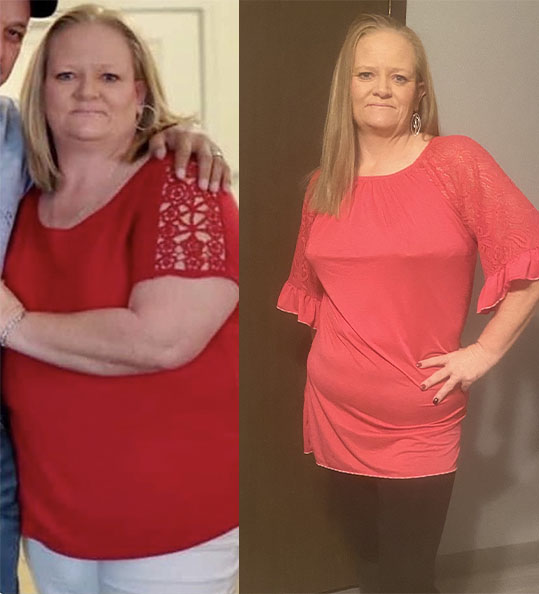 Laquitha's weight loss transformation