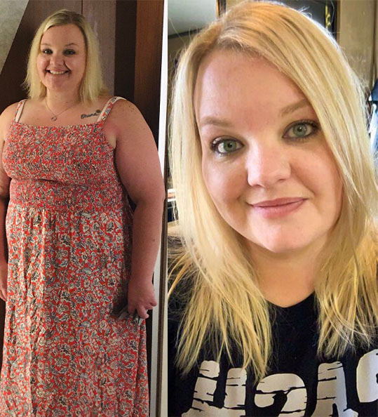 Laura's weight loss transformation
