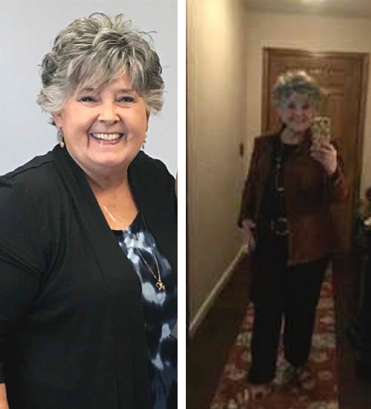 Margaret's weight loss transformation