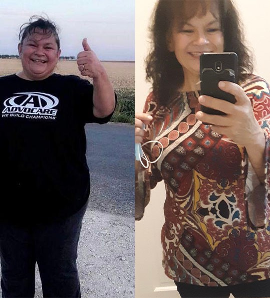Palmira's weight loss transformation