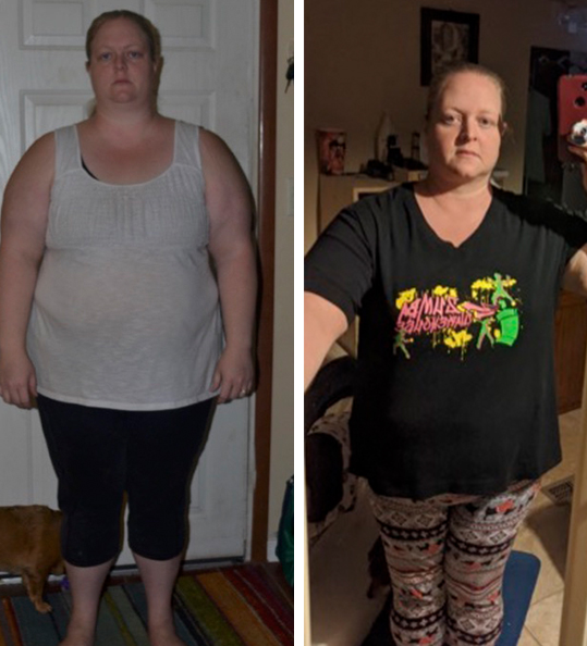 Robyn's weight loss transformation