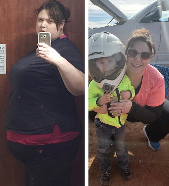 Stacey's weight loss transformation