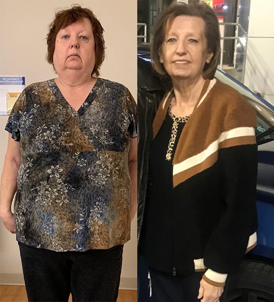 Tamela's weight loss transformation