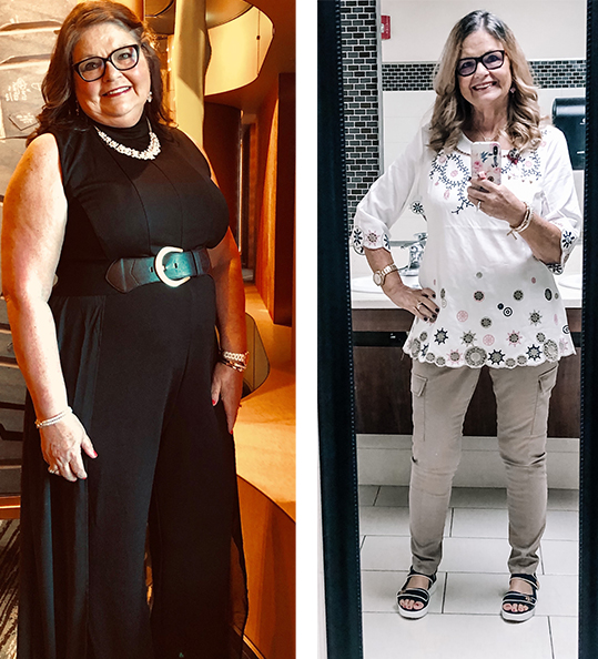 Terri's weight loss transformation