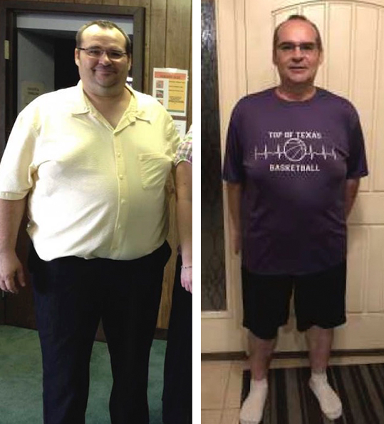 Tim's weight loss transformation