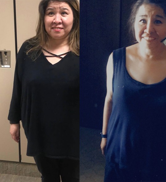 Valerie's weight loss transformation