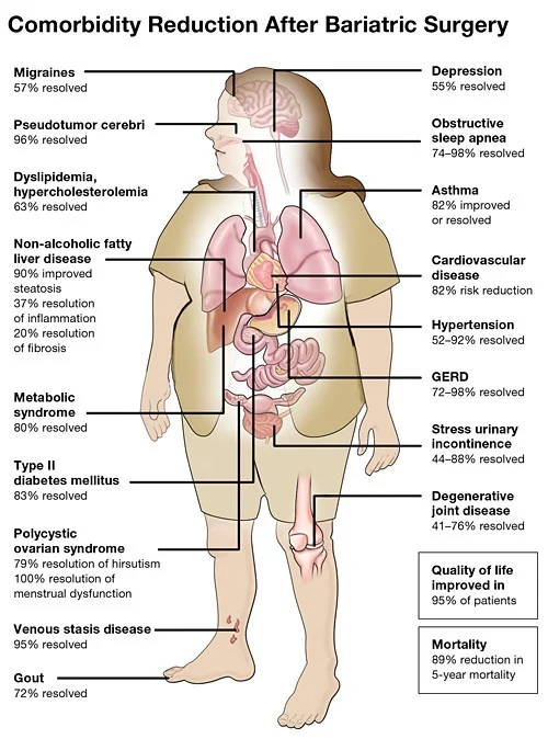 comorbidity graphic