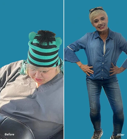 Patient Before After Image