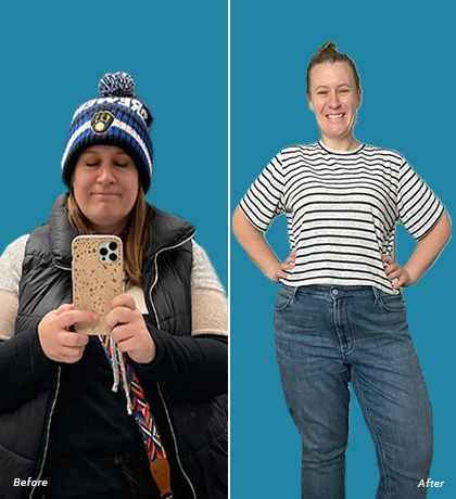 Patient Before After Image