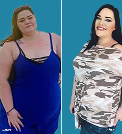 Patient Before After Image