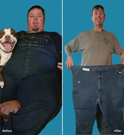 Patient Before After Image