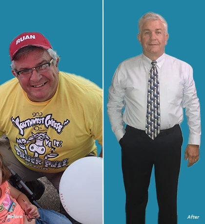 Patient Before After Image