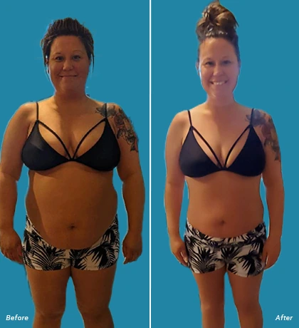 Patient Before After Image