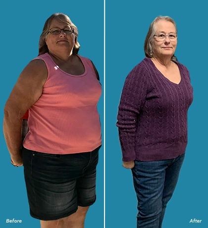 Patient Before After Image